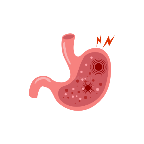 위장 문제 이미지